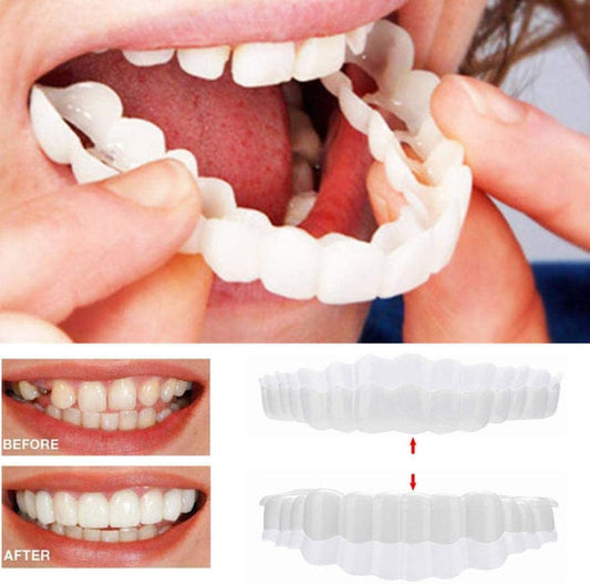 Sofort wirkende Veneers-Zahnblende - Mit Ober- und Unterkieferteil