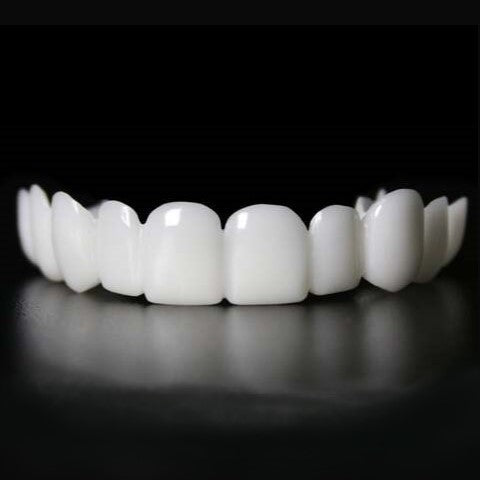 Snap-on Veneers – Sofortige Lächelnkorrektur gegen ästhetische Makel