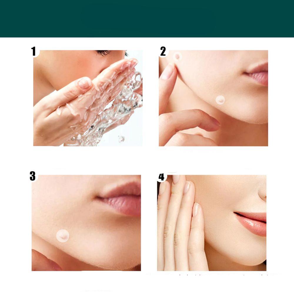 SkinClear Pflaster zur Entfernung von Hautanhängseln und Warzen | Hydrokolloid-Technologie | Schmerzfrei und diskret | Für alle Hauttypen | 120 Stück